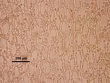 4 – Cellule corticali in visione superficiale